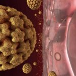 papilomavirusi-hpv-infekcija-polne-bradavice-kondilomi
